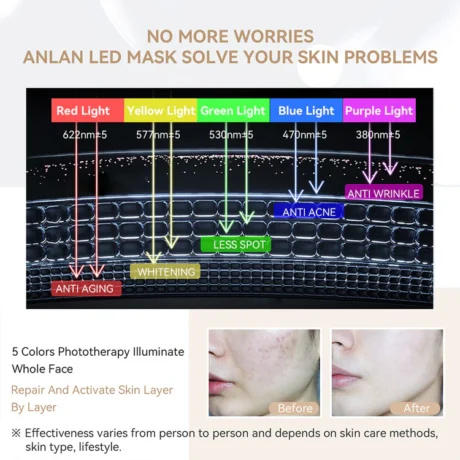 light therapy mask 4