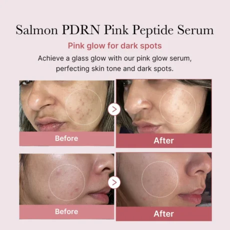 pdrn pink peptide serum 2