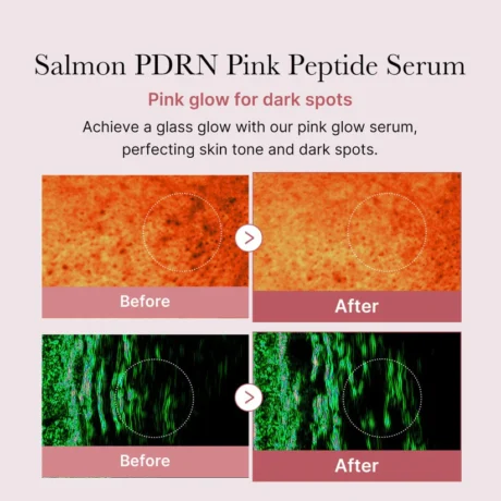 pdrn pink peptide serum 6